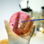 الخلايا الجذعية للبشرة الجافة