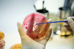 المدونة 26 الخلايا الجذعية للبشرة الجافة