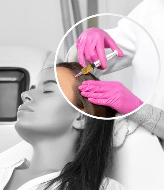 Hair Mesotherapy 2
