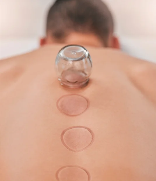 dry cupping