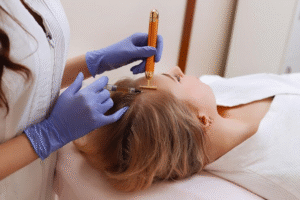 المدونة 56 كيفية الاستعداد لجلسة البلازما للشعر