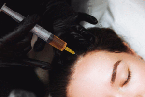 كيفية الاستعداد لجلسة البلازما للشعر