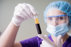 المدونة 55 نتائج البلازما PRP للشعر