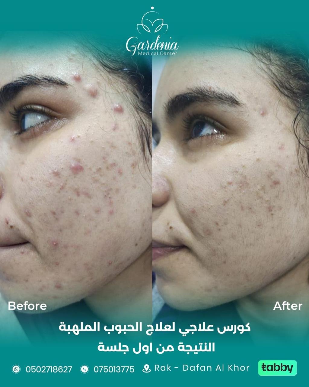 04775349-9f5f-45f3-95b3-148d996e986c