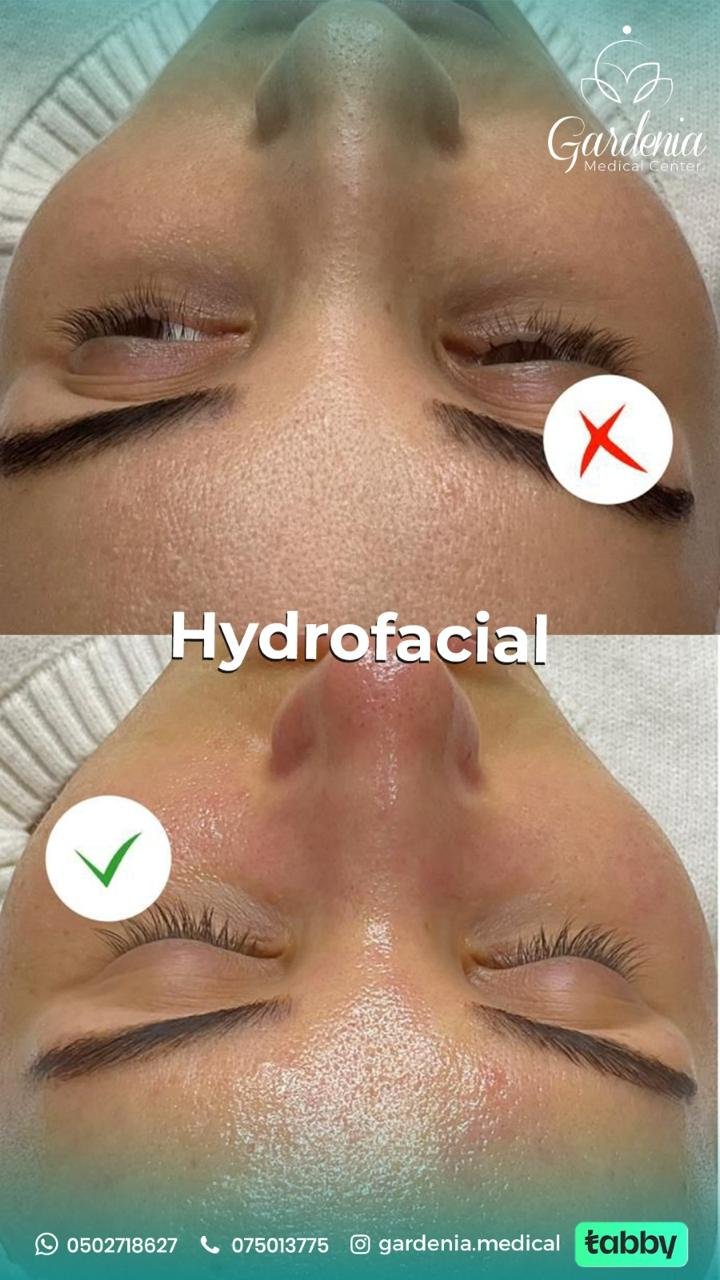 0c0281cb-e66b-4f56-84e6-1f82323613f2