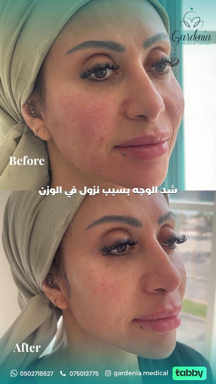 5f14060f-b48c-45b6-9c73-35606adf6e2f