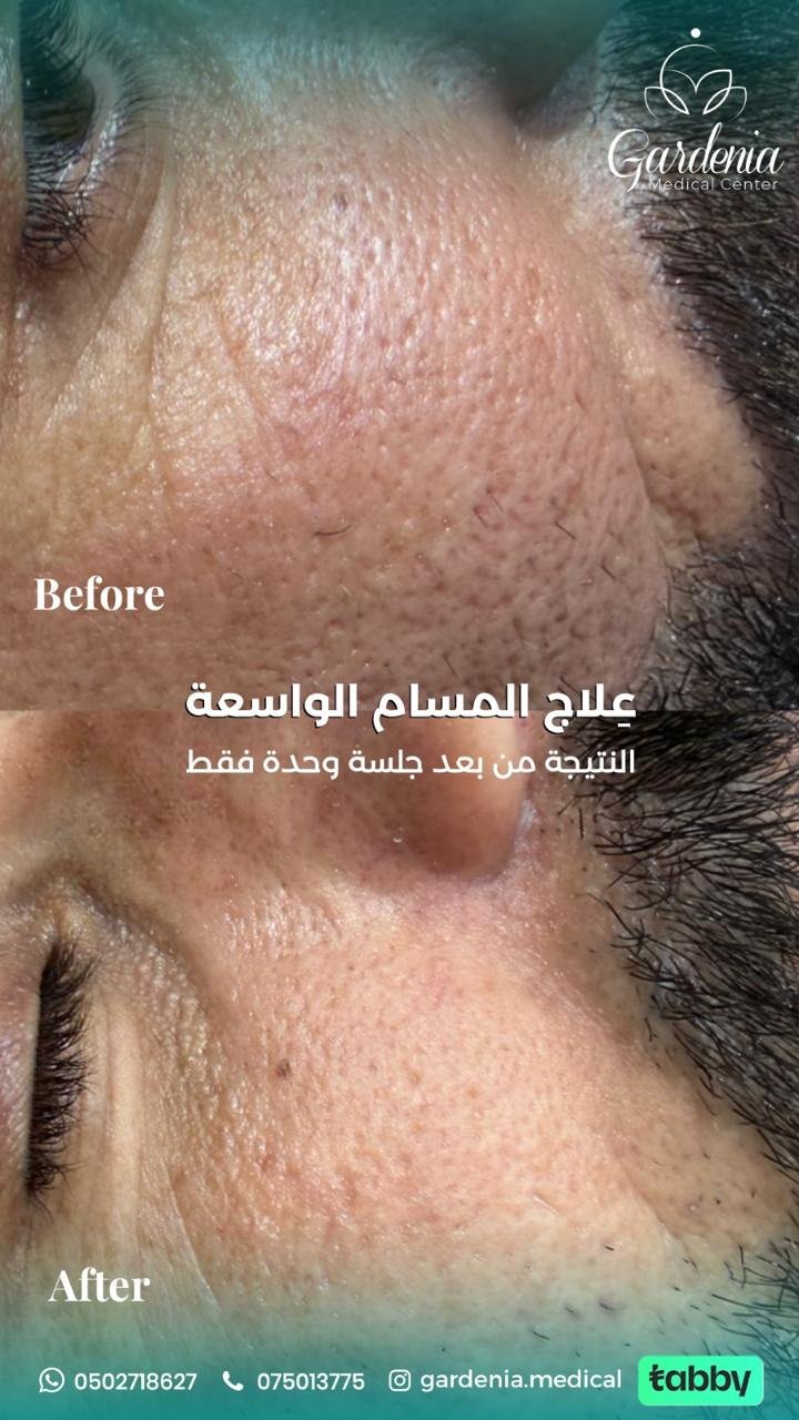 b58df8ed-c8a6-4f92-8545-388c73dd51d8