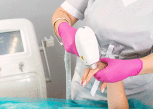 عدد جلسات إزالة الشعر بالليزر