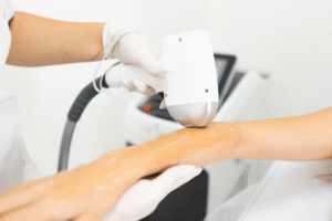 أسعار إزالة الشعر بالليزر للنساء