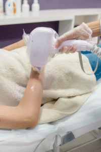 المدة بين جلسات إزالة الشعر بالليزر