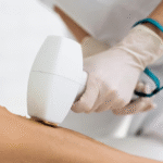 أسعار إزالة الشعر بالليزر للنساء في رأس الخيمة: دليل شامل للتكلفة وأهم العوامل 9 أسعار إزالة الشعر بالليزر للنساء