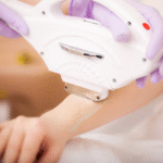 عدد جلسات إزالة الشعر بالليزر