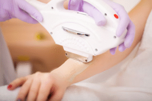 الليزر أم الحلاقة