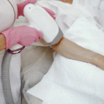 الليزر أم IPL لإزالة الشعر